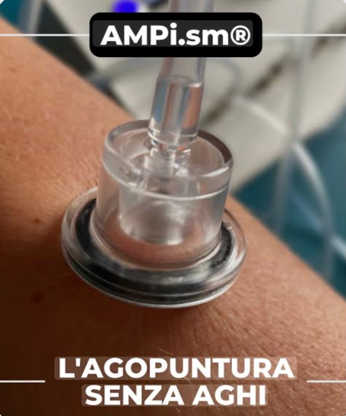 Agopuntura senza aghi con AMPI.sm
